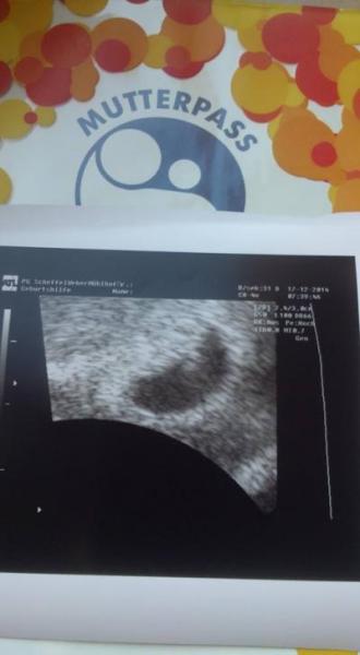 Bild zu Gestern FA Termin - Forum für September - Mamis