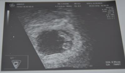 Bild zu Herzchen schlägt bei 7+0 juchu.....alles gut!! - Forum für September - Mamis