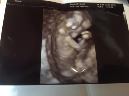 Bild zu Vom Arzt zurück - Forum für September - Mamis