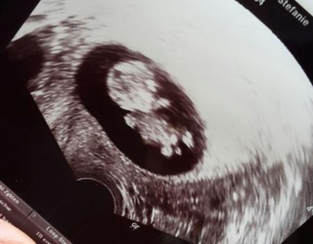 Bild zu Pures Glück :) - Forum für September - Mamis