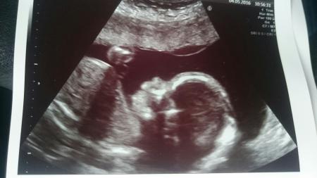 Bild zu Heute Organscreening gehabt! - Forum für September - Mamis