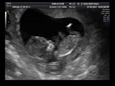 Bild zu Von uns auch mal ein Foto :o) - Forum für September - Mamis