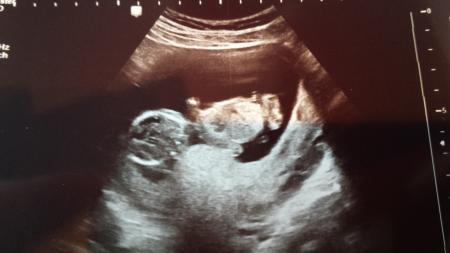 Bild zu Mein Baby zeigt mir jetzt schon die kalte Schulter... ;) - Forum für September - Mamis