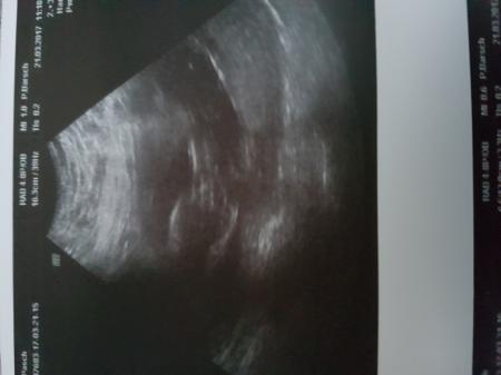 Bild zu Termin beim FA - Forum für September - Mamis