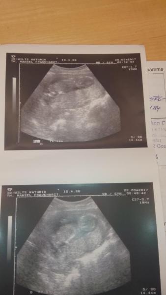 Bild zu Arzt alles schick mit bild - Forum für September - Mamis