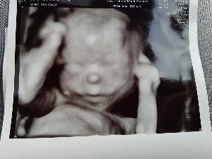 Bild zu Alles ist Perfekt - Forum für September - Mamis