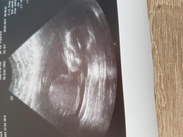 Bild zu Termin beim FA und erstes CTG - Forum für September - Mamis