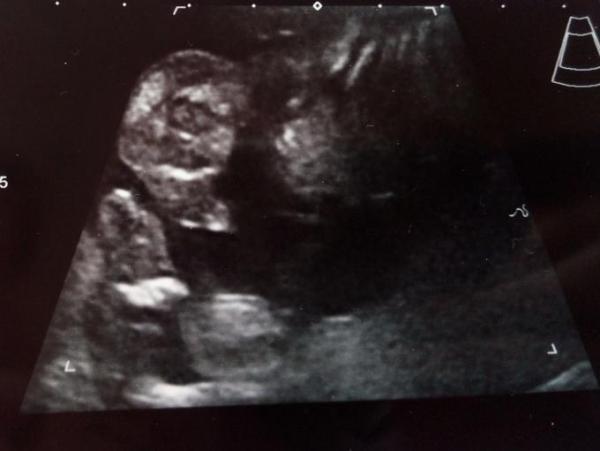 Bild zu Übelkeit wieder da & Outingbild - Forum für September - Mamis