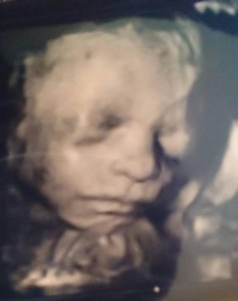 Bild zu Baby-TV - Forum für September - Mamis