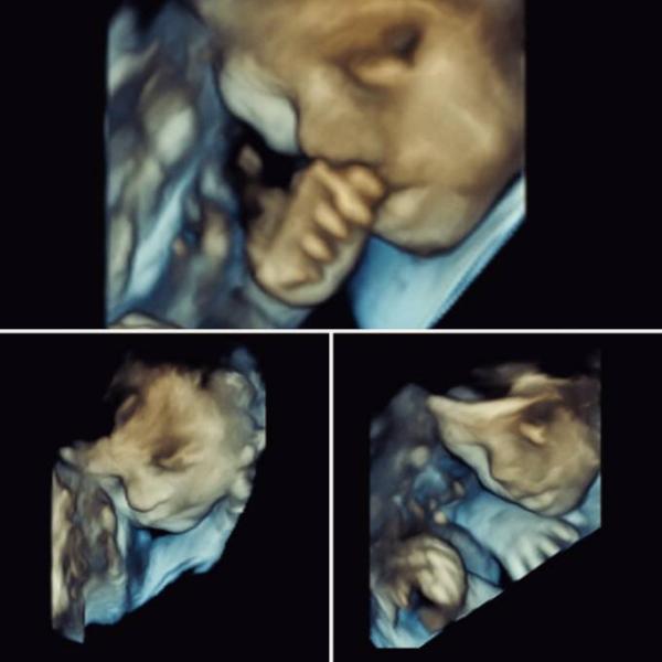 Bild zu 3D Ultraschall :) - Forum für September - Mamis