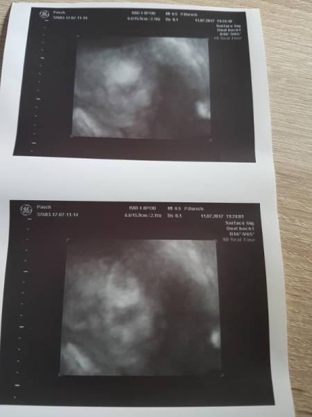 Bild zu FA Termin und Geburtsgespräch - Forum für September - Mamis