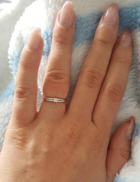 Bild zu PROBLEM: Urplötzlich angeschwollene Finger - Forum für September - Mamis
