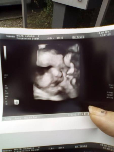 Bild zu 4d Bild und Geburtsbesprechung - Forum für September - Mamis
