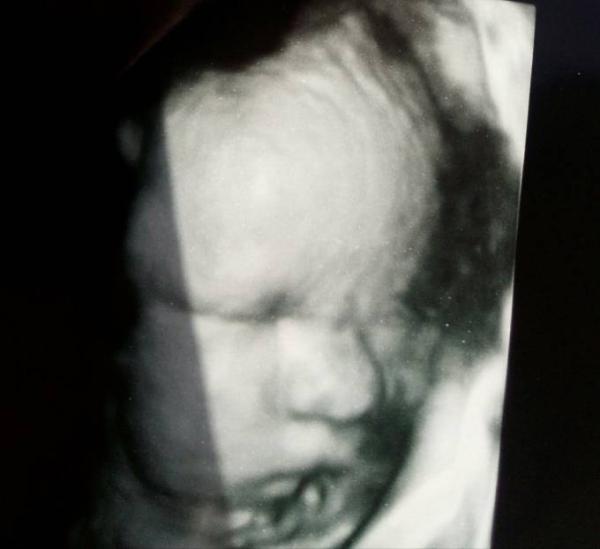 Bild zu US Bild und noch 6 Tage! - Forum für September - Mamis