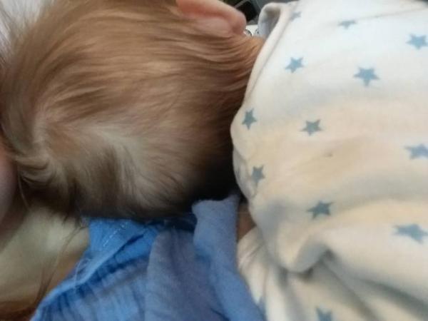 Bild zu Kahle stelle am Hinterkopf - Forum für September - Mamis