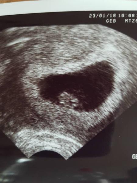 Bild zu Zurück vom Fa - Forum für September - Mamis