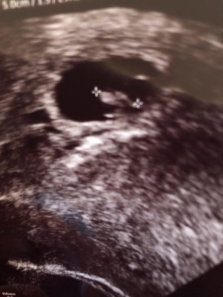 Bild zu Auch Termin und wurde zurückdatiert - Forum für September - Mamis
