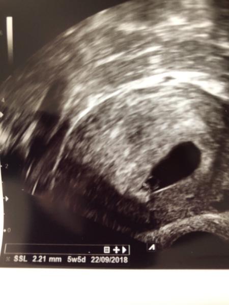 Bild zu FA Termin: ist das jetzt gut oder schlecht? - Forum für September - Mamis