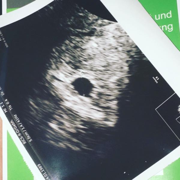 Bild zu Die Angst bleibt .... - Forum für September - Mamis