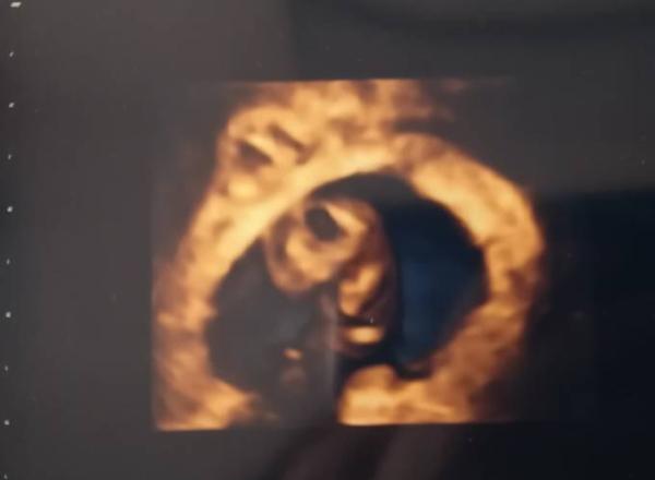 Bild zu ZurĂŒck vom FA đ - Forum fĂŒr September - Mamis