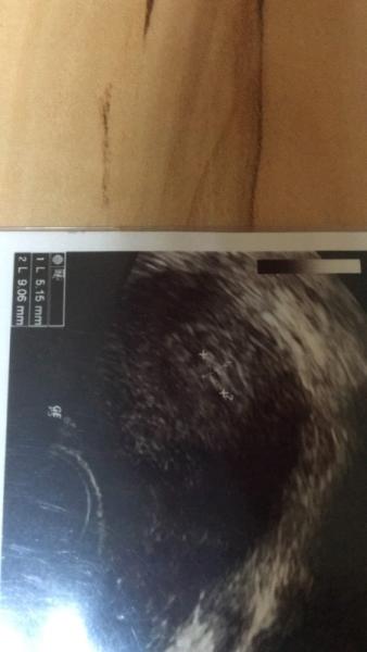 Bild zu fa termin was sagt ihr - Forum für September - Mamis