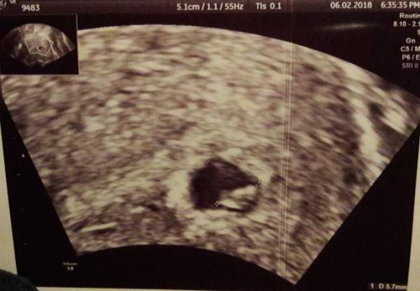 Bild zu Zurück vom Arzt... - Forum für September - Mamis