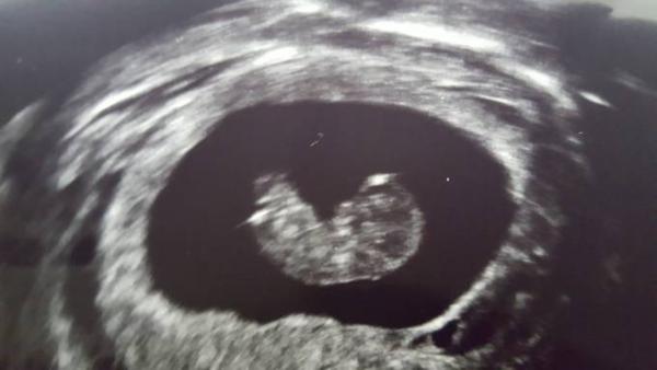Bild zu Verliebt - Forum für September - Mamis
