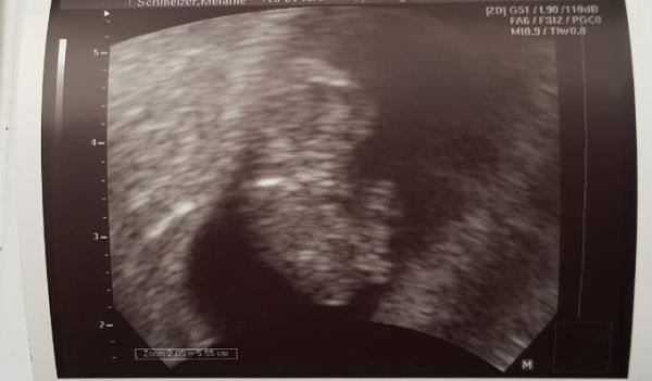 Bild zu 10. SSW und zugenommen - Forum für September - Mamis
