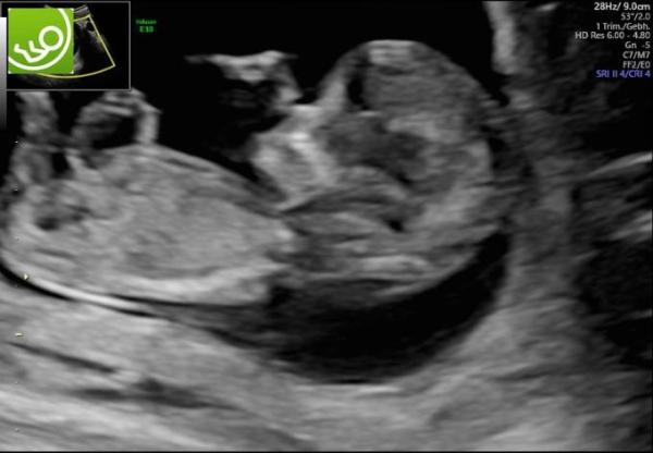 Bild zu Arztbericht und aufatmen - Forum für September - Mamis