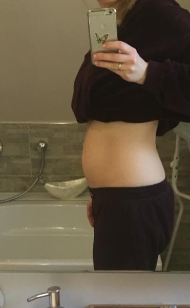 Bild zu Langsam kommt der Bauch und Hilfe Pickel #266 - Forum für September - Mamis