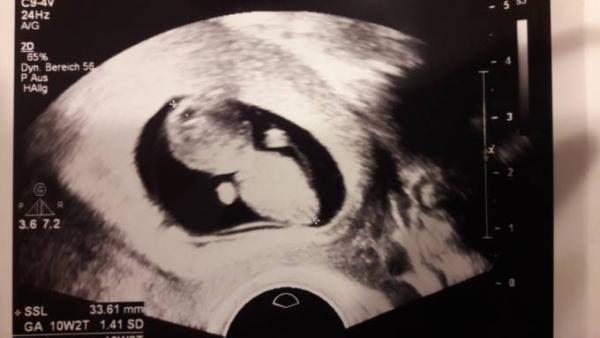 Bild zu Alles gut bisher - Forum für September - Mamis