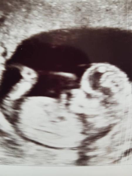 Bild zu Uns gibt's auch noch 🙈 - Forum für September - Mamis