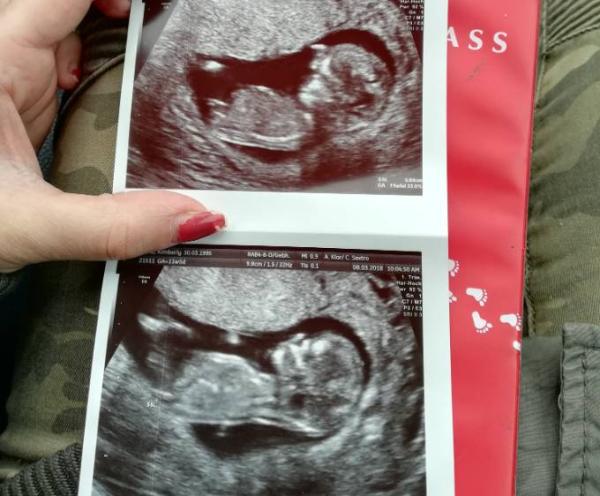 Bild zu TÜV soweit erstmal bestanden. - Forum für September - Mamis