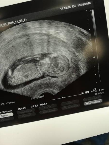 Bild zu Oh man.. Was für ein Tag. - Forum für September - Mamis
