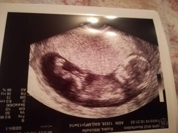 Bild zu FA Termin - Forum für September - Mamis