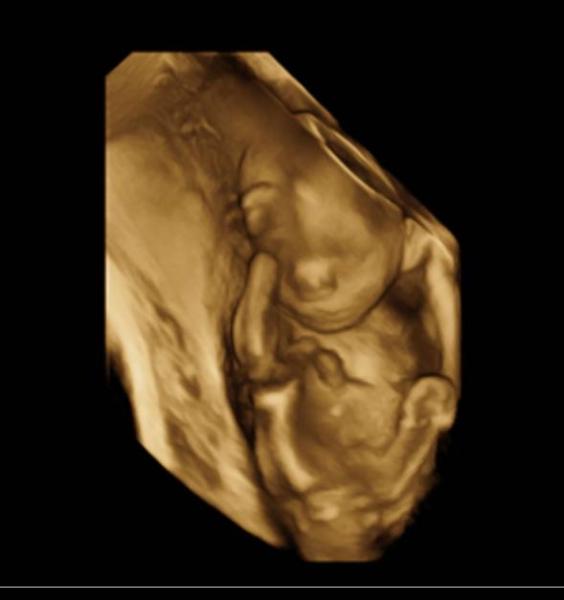 Bild zu Einfach nur glücklich💙💙💙 - Forum für September - Mamis