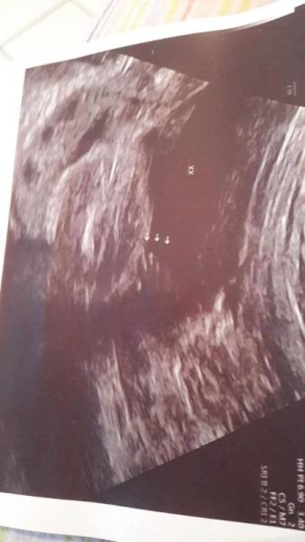 Bild zu ich steige auch ein - Forum für September - Mamis