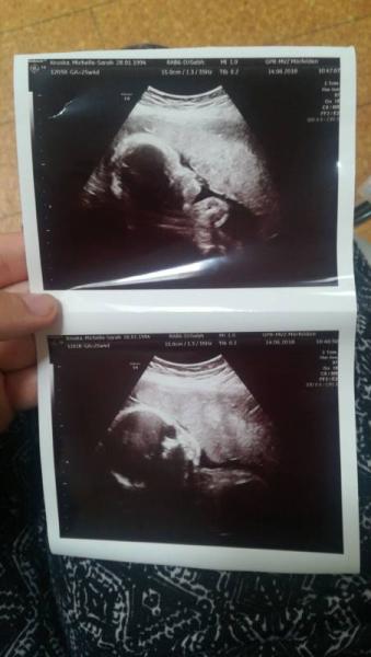 Bild zu Spontaner Ultraschall :)  - Forum für September - Mamis