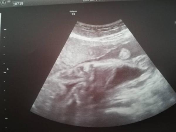 Bild zu Doch kein so sicheres outing?? - Forum für September - Mamis