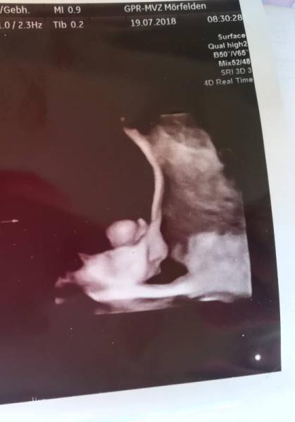 Bild zu Letzter großer Ultraschall - Forum für September - Mamis