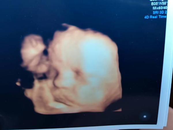 Bild zu Zurück vom FA 😎 - Forum für September - Mamis