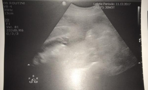 Bild zu Welches Geschlecht? - Forum für September - Mamis