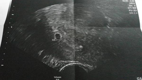 Bild zu Heute FA Termin - Forum für September - Mamis