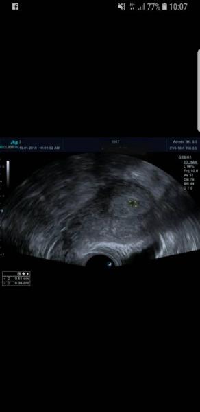 Bild zu Mein Pünktchen ist da... - Forum für September - Mamis