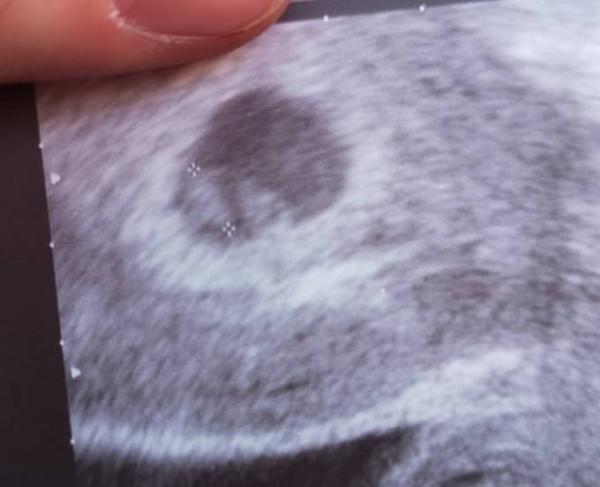 Bild zu Heute Arzttermin gehabt - Forum für September - Mamis