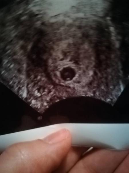 Bild zu Ebenfalls zurück vom FA - Forum für September - Mamis