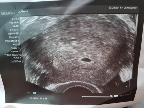 Bild zu Zurück vom gyn - Forum für September - Mamis