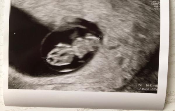 Bild zu 2. FA-Termin - Forum für September - Mamis