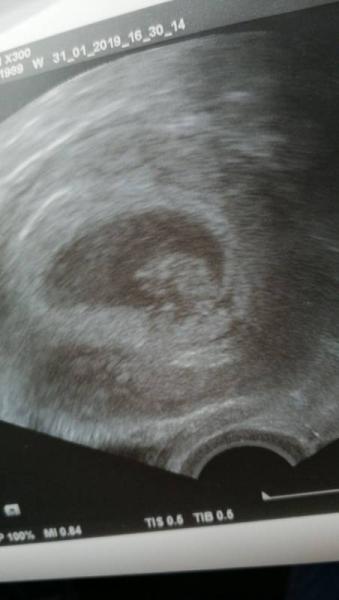 Bild zu Zurück vom Frauenarzt. - Forum für September - Mamis