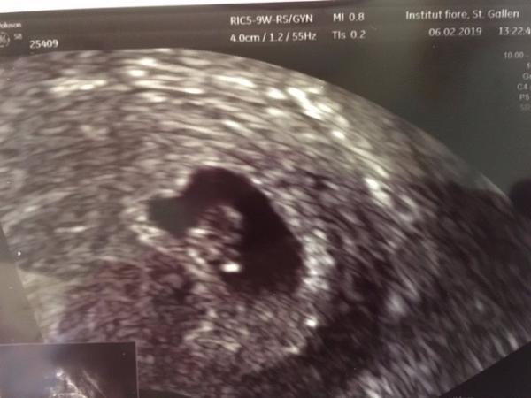 Bild zu 1. US - 6 + 3 - Forum für September - Mamis